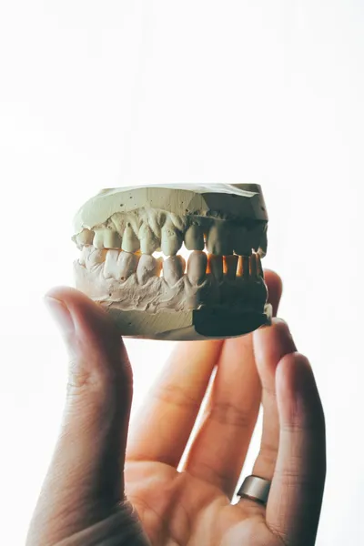 Everything You Need to Know About Getting Dentures and Partials in 2024Illustration